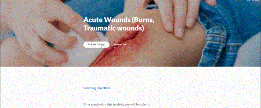 Acute wounds